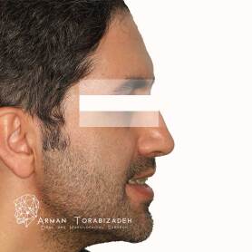 نمونه کار جراحی دو فک در تهران