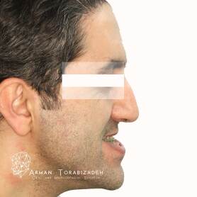 نمونه کار جراحی دو فک در تهران
