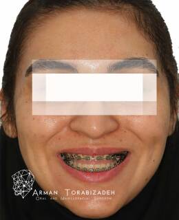 نمونه کار جراحی فک